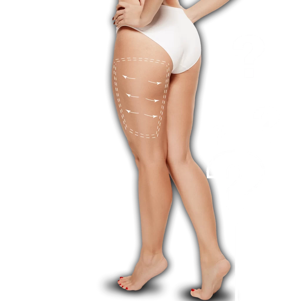 How-Much-Does-Vaser-Liposuction-Cost_edi