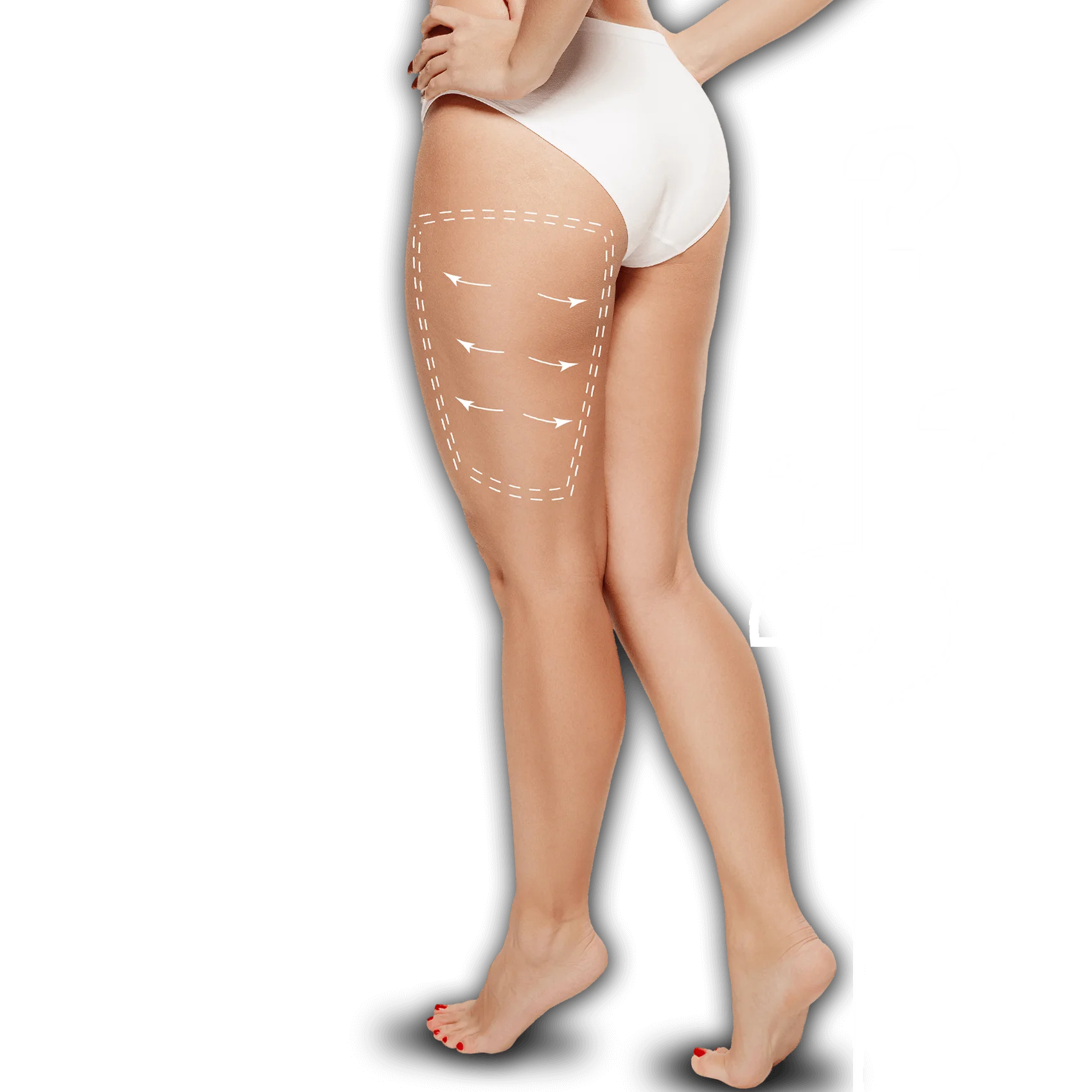 How Much Does Thighplasty (Inner Thigh Lifting) Cost