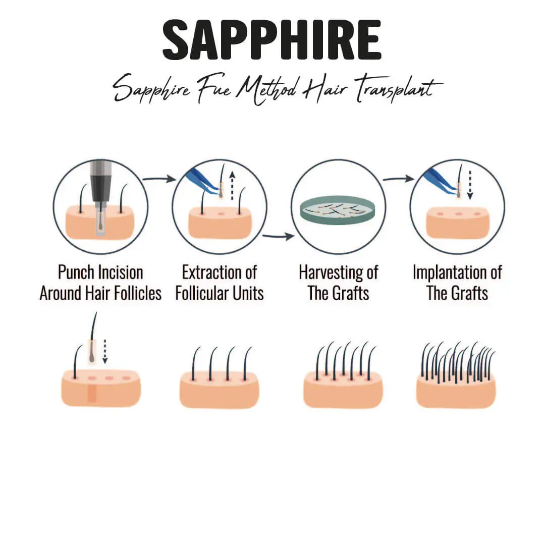 sapphire-technique