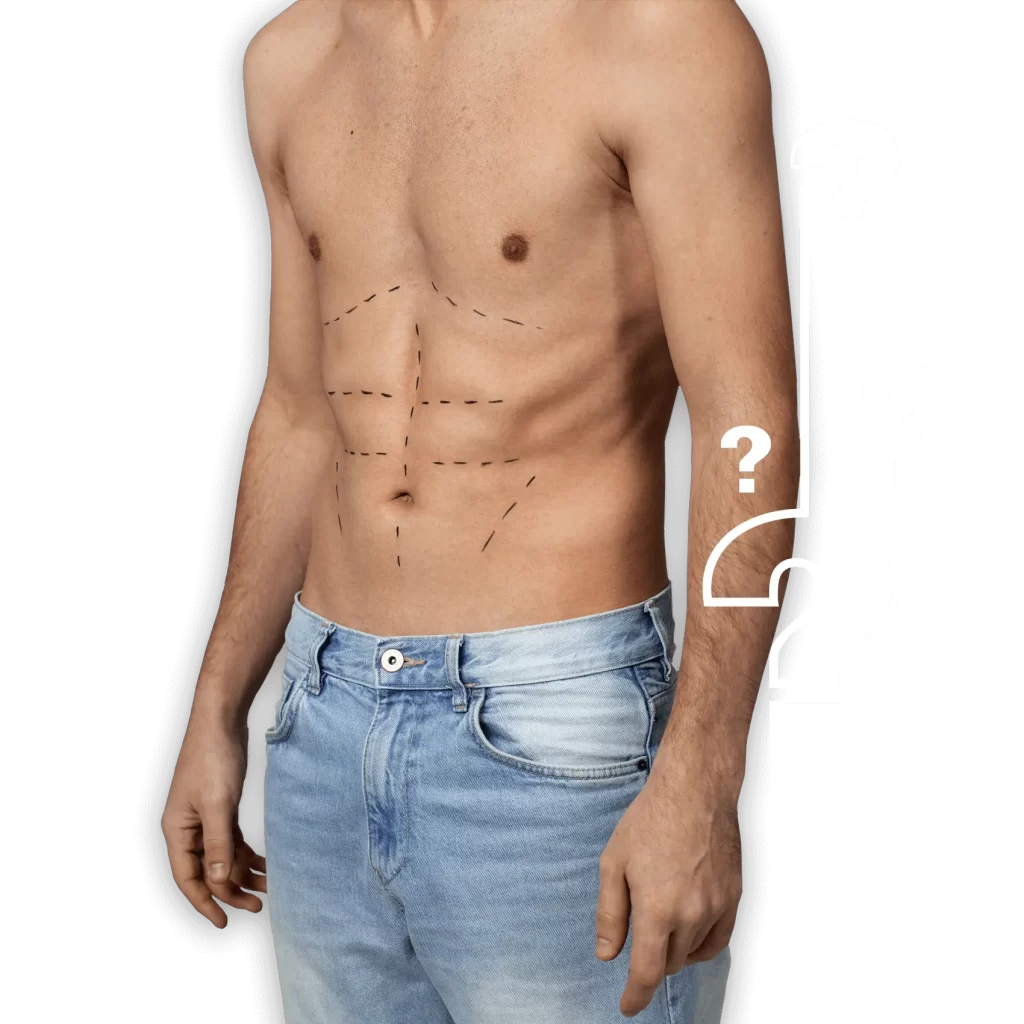 How-Much-Does-Vaser-Liposuction-Cost_edi
