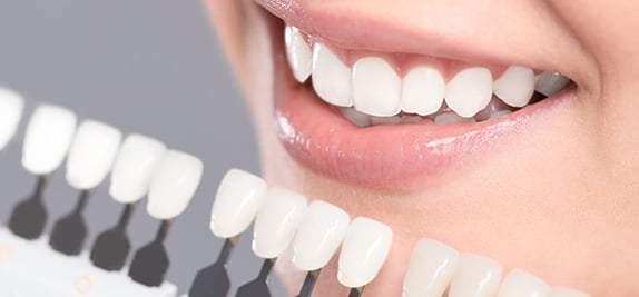 What’s the difference between Zirconium, Porcelain, and E-max crowns?