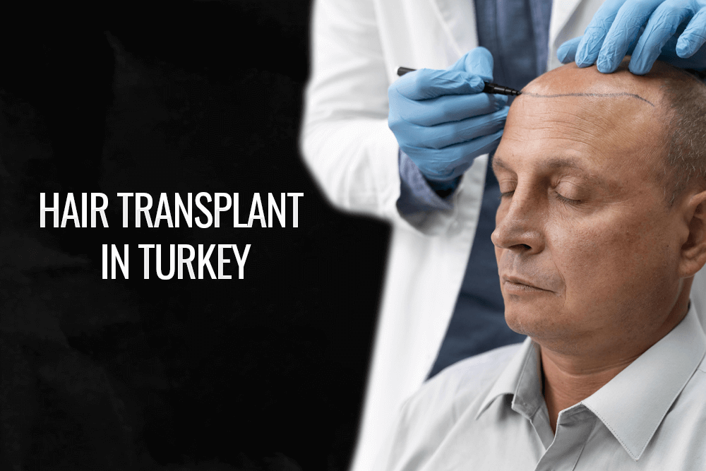 Best Hair Transplant in Istanbul,Turkey