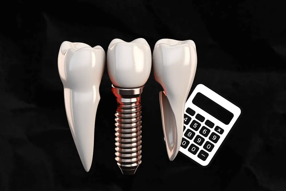 The Cost of Dental Implants in Turkey
