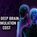Deep Brain Stimulation Cost