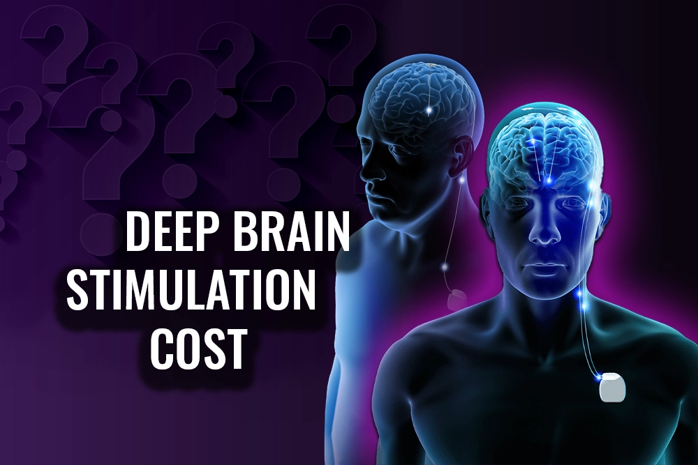 Deep Brain Stimulation Cost