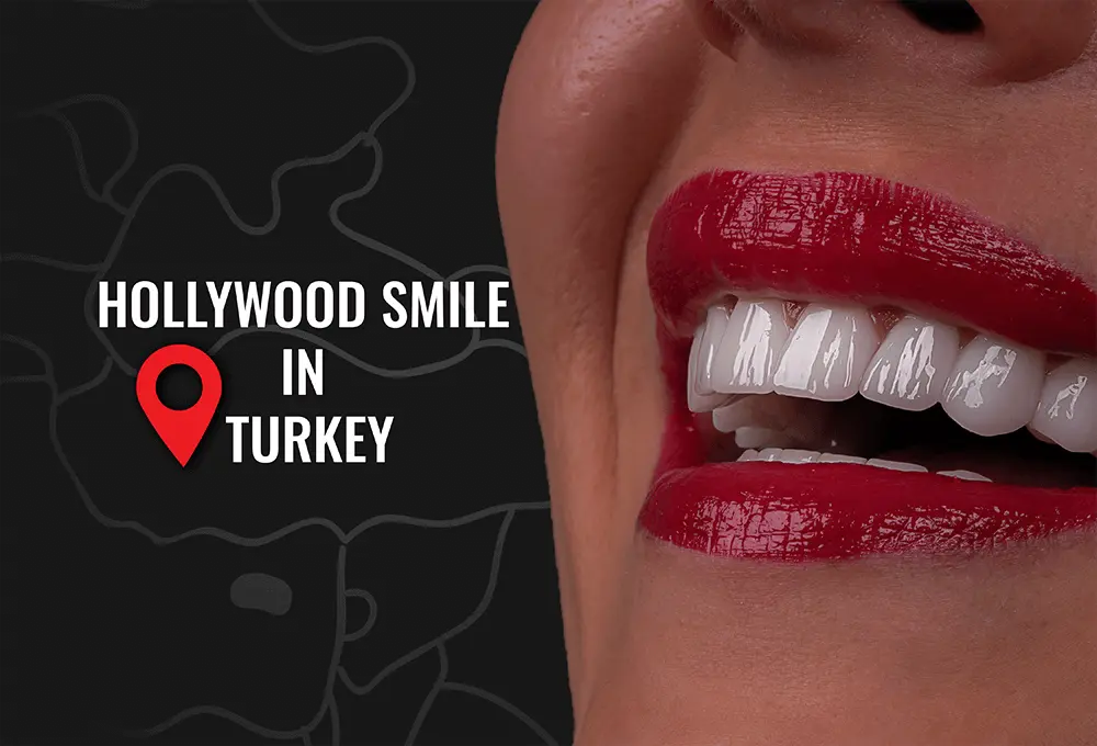 Hollywood Smile in Turkey