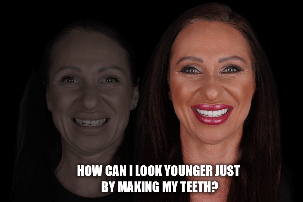 How Can I Look Younger Just By Making My Teeth?
