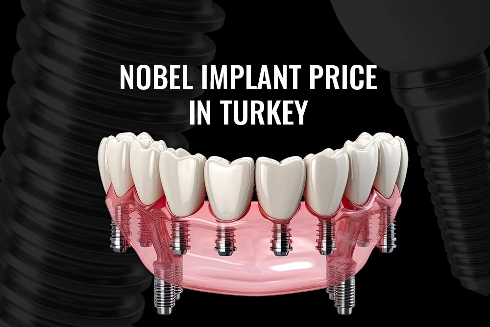 Nobel Dental Implant Price in Turkey