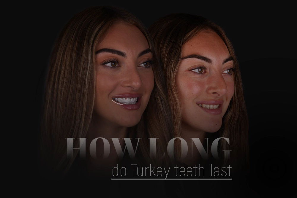 How Long Do Turkey Teeth Last