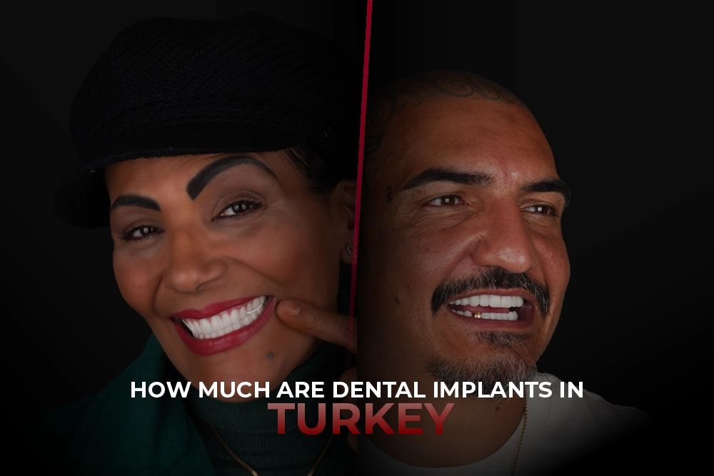 How Much Are Dental Implants In Turkey