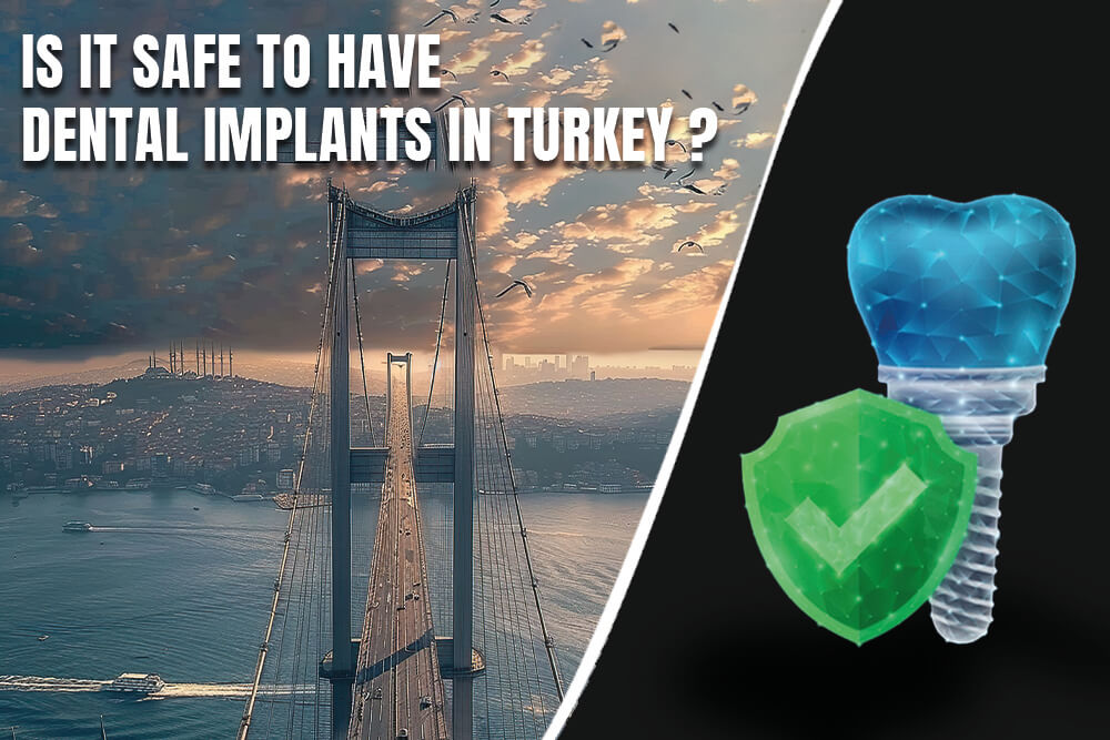 Is It Safe To Have Dental Implants In Turkey