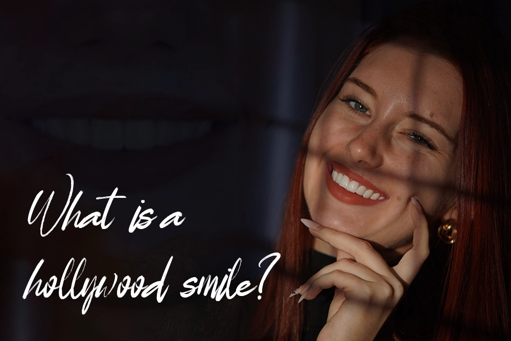 What Is a Hollywood Smile?