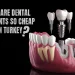 Why Are Dental Implants So Cheap In Turkey