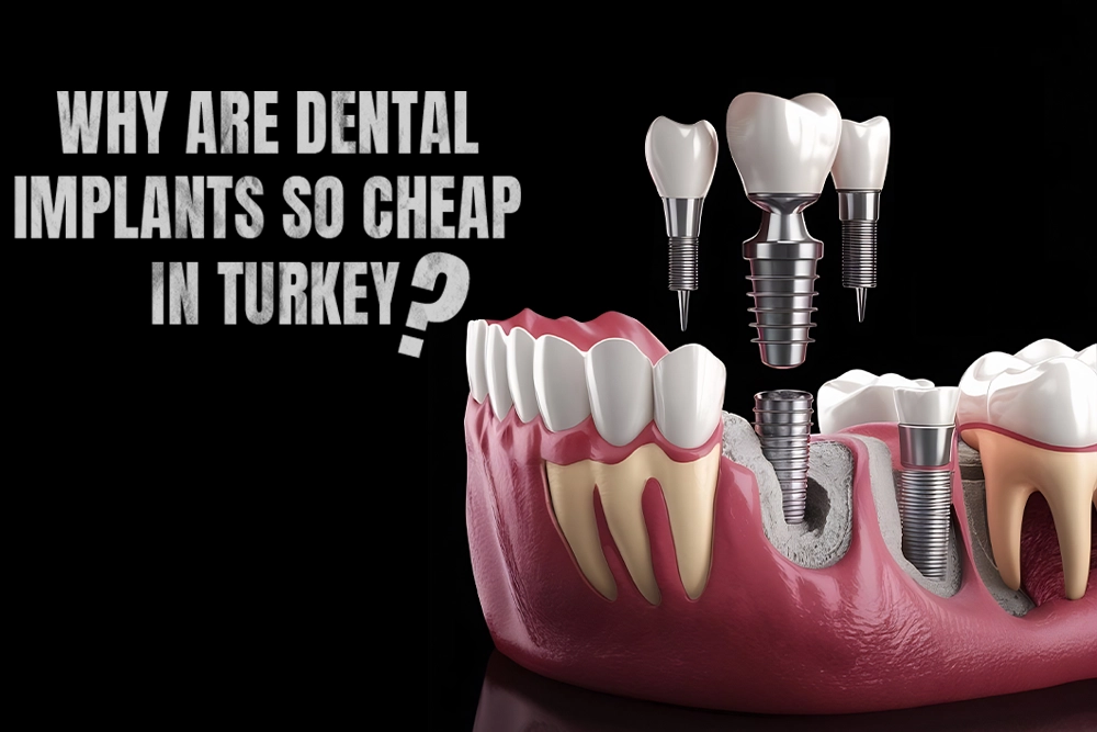 Why Are Dental Implants So Cheap In Turkey