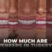 How Much Are Dental Veneers In Turkey