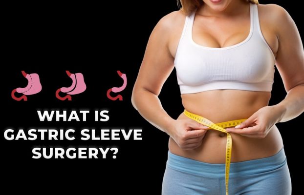 What Is Gastric Sleeve Surgery?