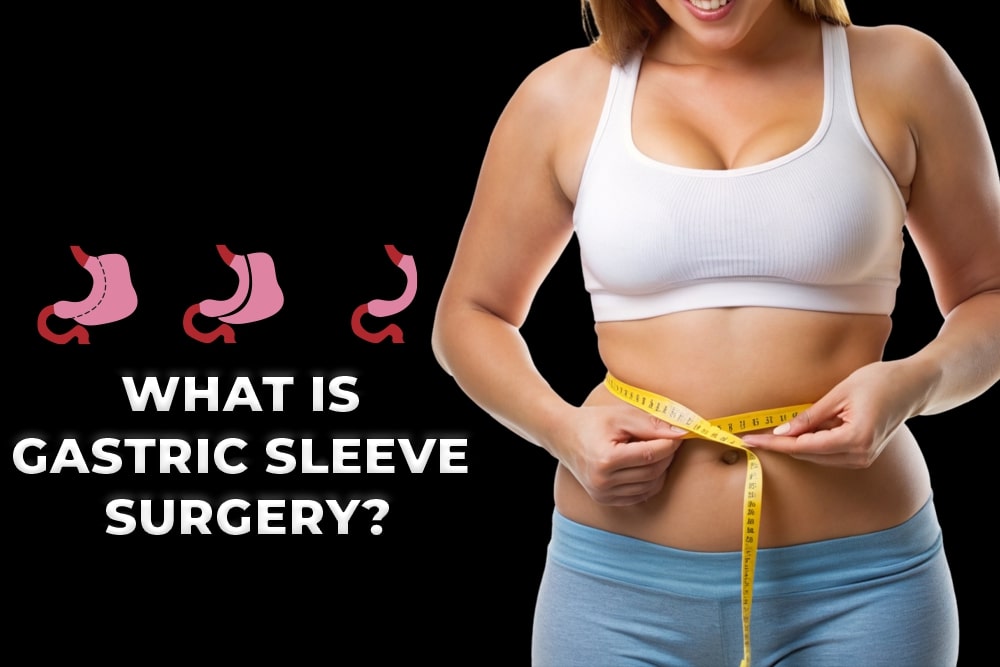 What Is Gastric Sleeve Surgery?