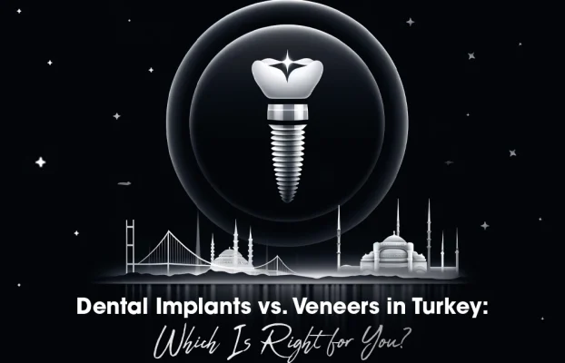 Dental Implants vs Dental Veneers in Turkey : Which Is Right for You?