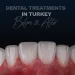 Dental Treatments in Turkey Teeth Before and After Photos