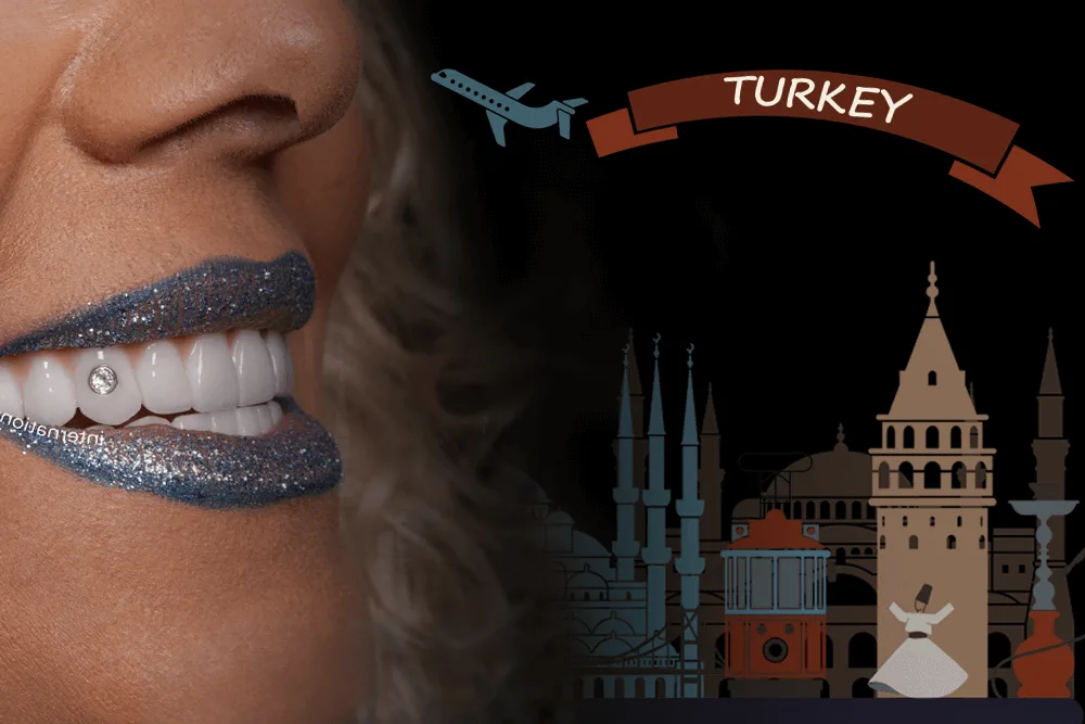 Full Mouth Dental implant Turkey Package Deals