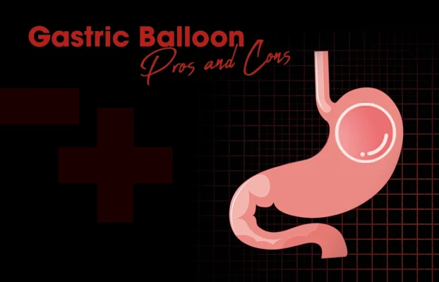 Gastric Balloon Pros and Cons