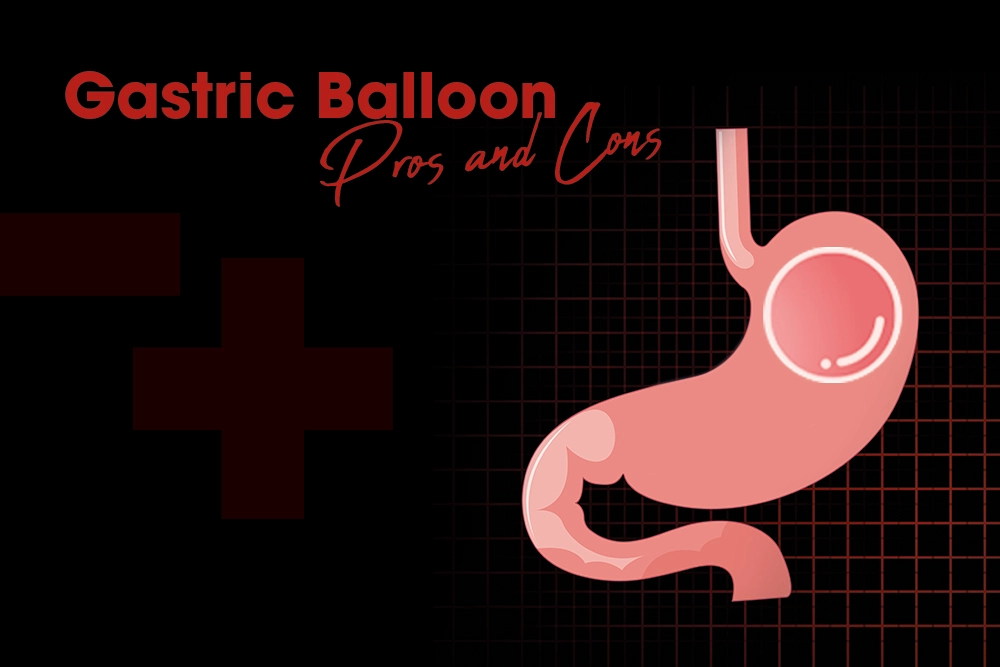 Gastric Balloon Pros and Cons