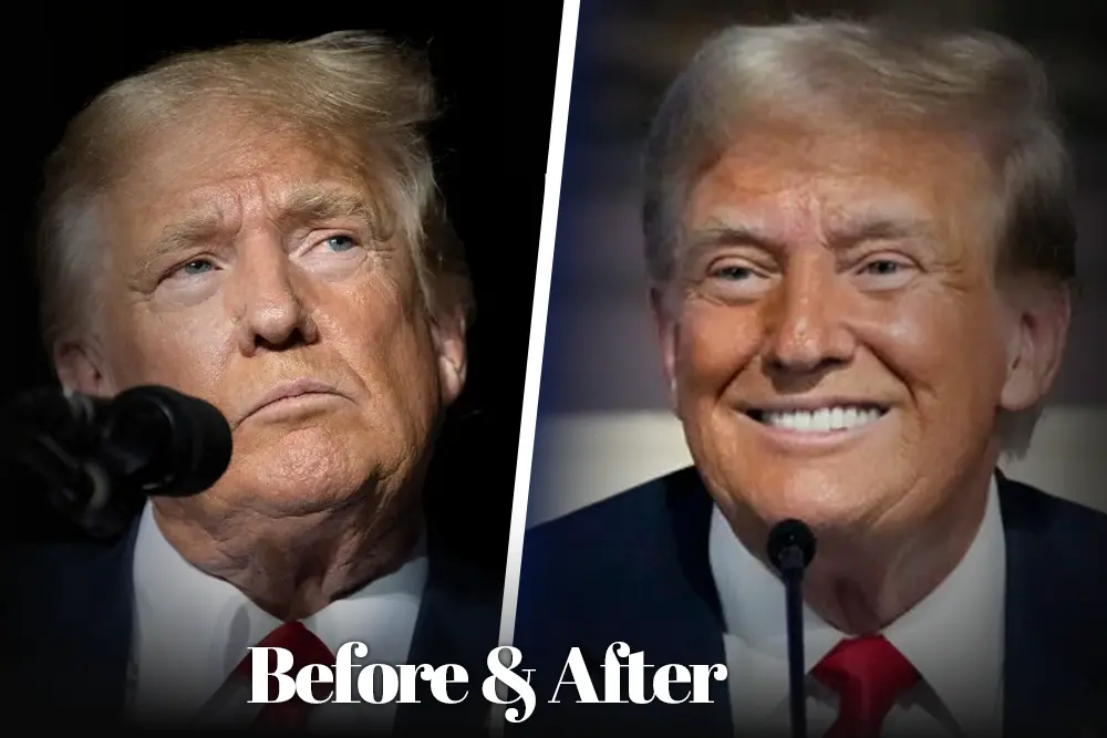 Trump Teeth Before and After 2025