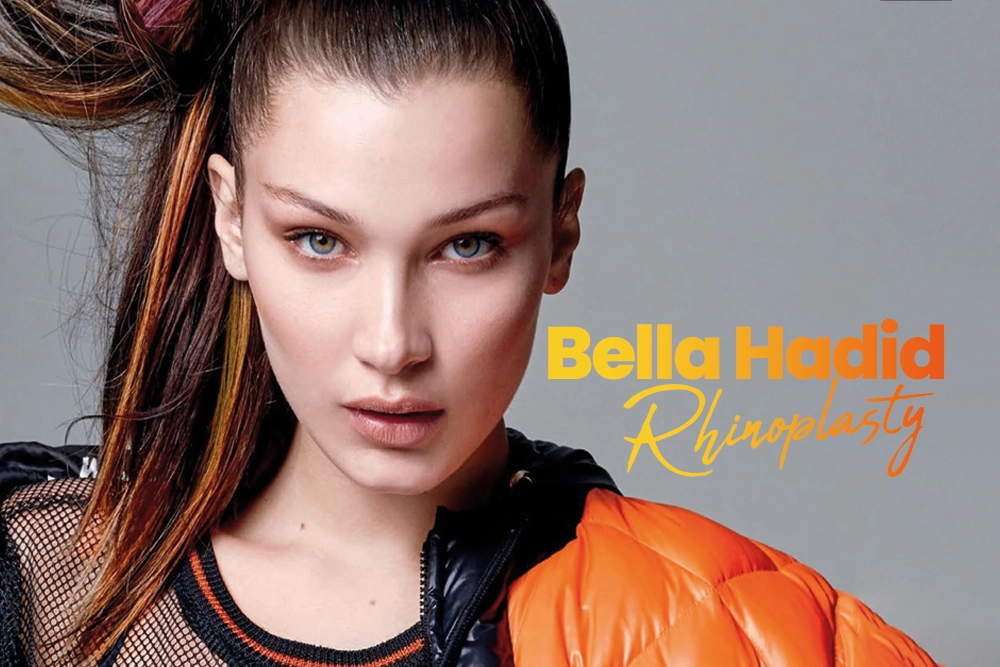 Bella Hadid Rhinoplasty