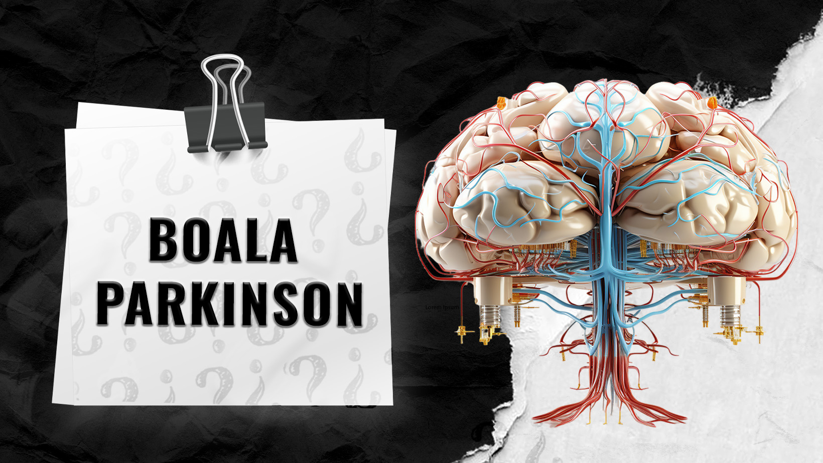 Boala-Parkinson