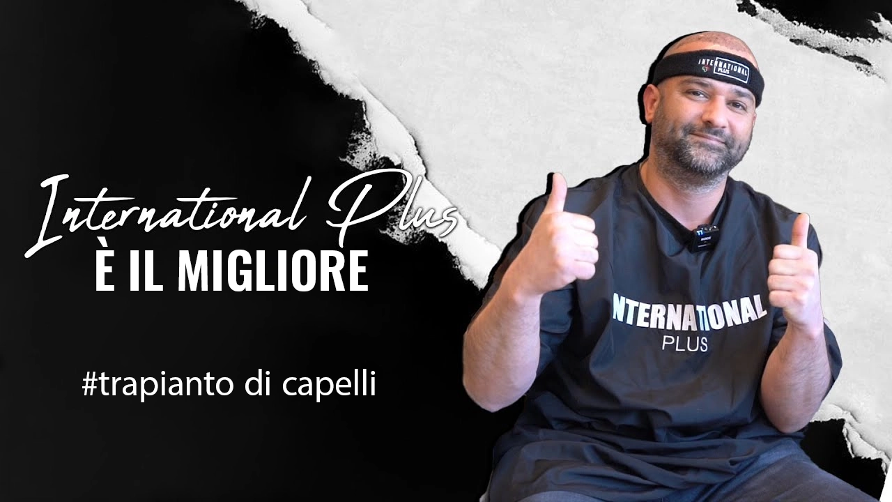 Chi-si-qualifica-per-il-trapianto-di-capelli-1