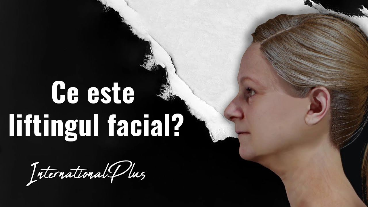 Cine-se-califica-pentru-liftingul-facial