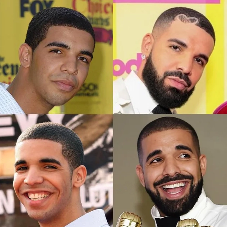 Drake Plastic Surgeries