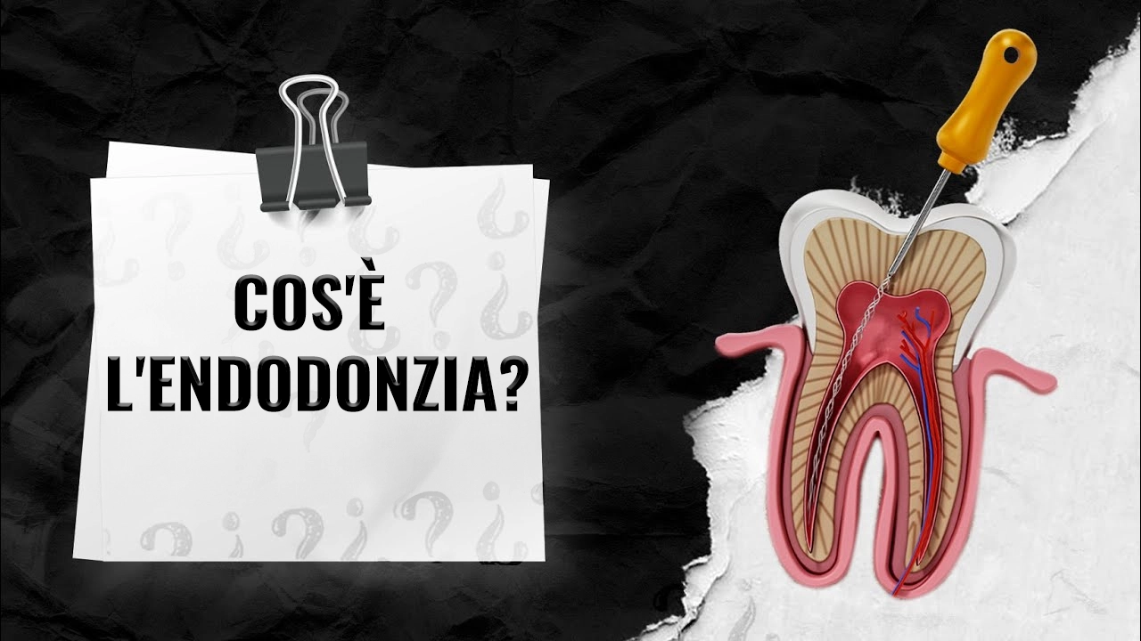 Endodonzia-a-Istanbul-Turchia