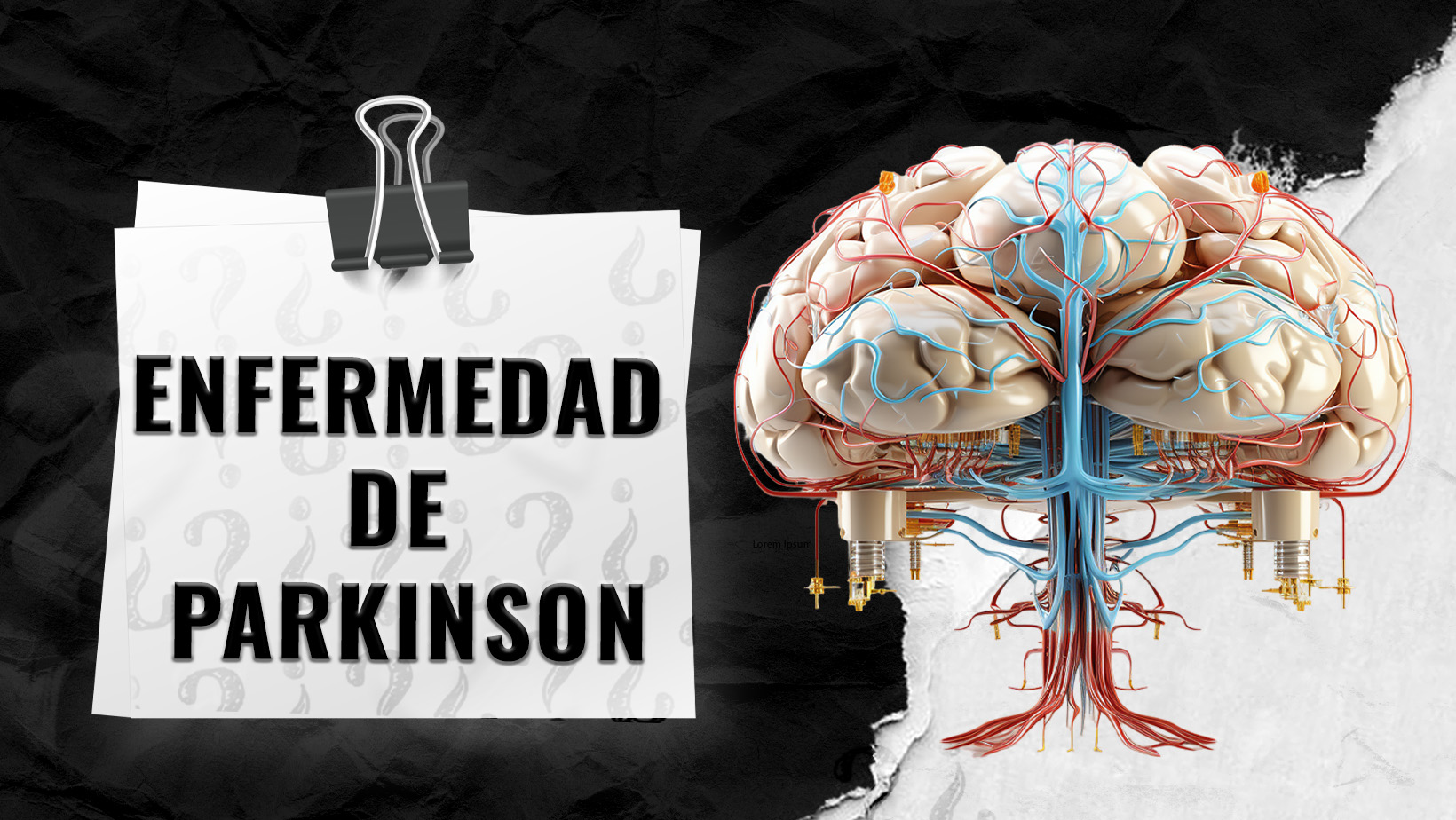 Enfermedad-de-Parkinson