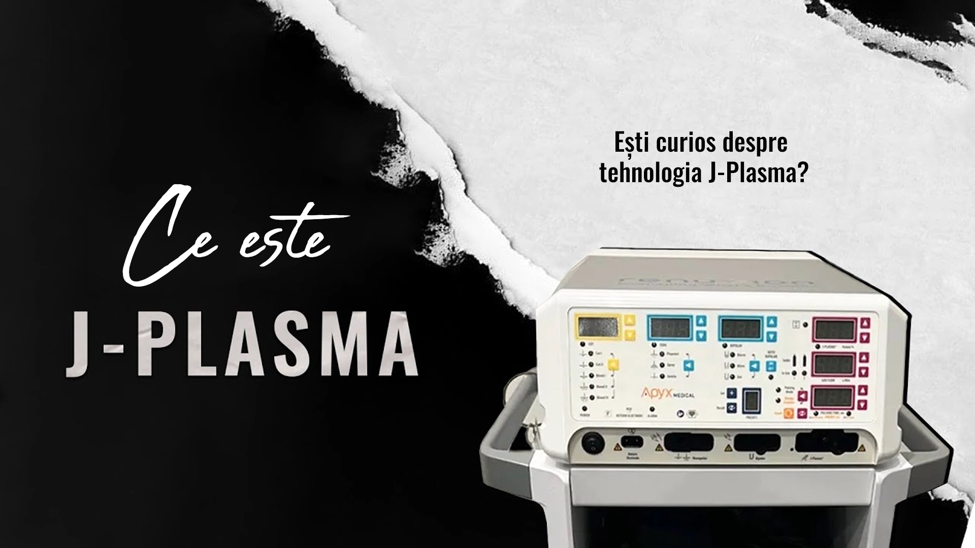 J-plasma-in-IstanbulTurcia