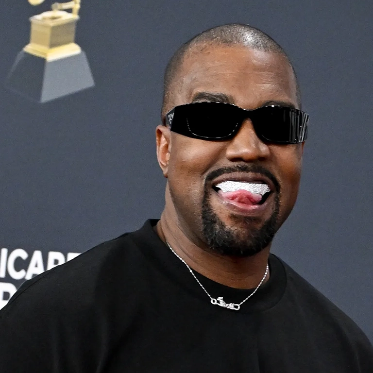 Kanye West Fixed Prosthodontics