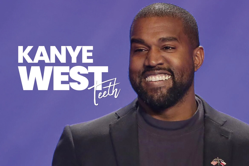 Kanye West Teeth