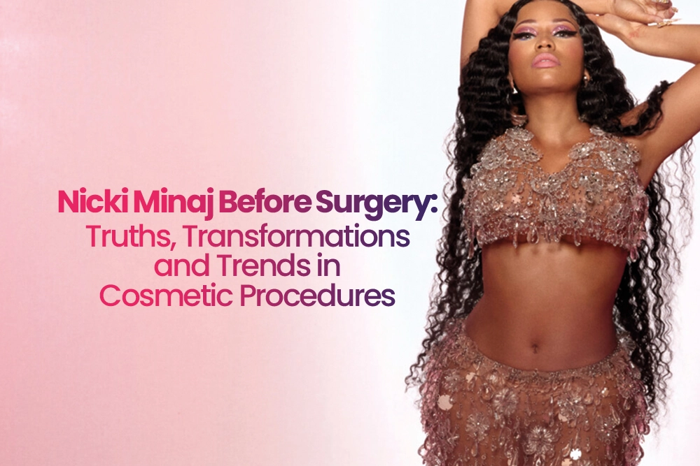 Nicki Minaj Before Surgery Truths Transformations and Trends in Cosmetic Procedures