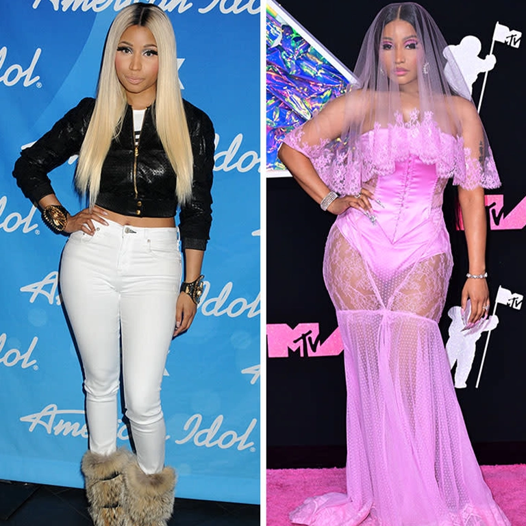 Nicki Minaj Before and After