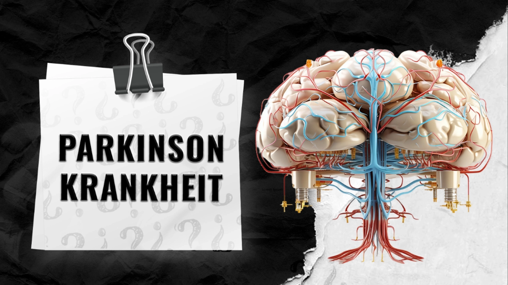 Parkinson-Krankheit