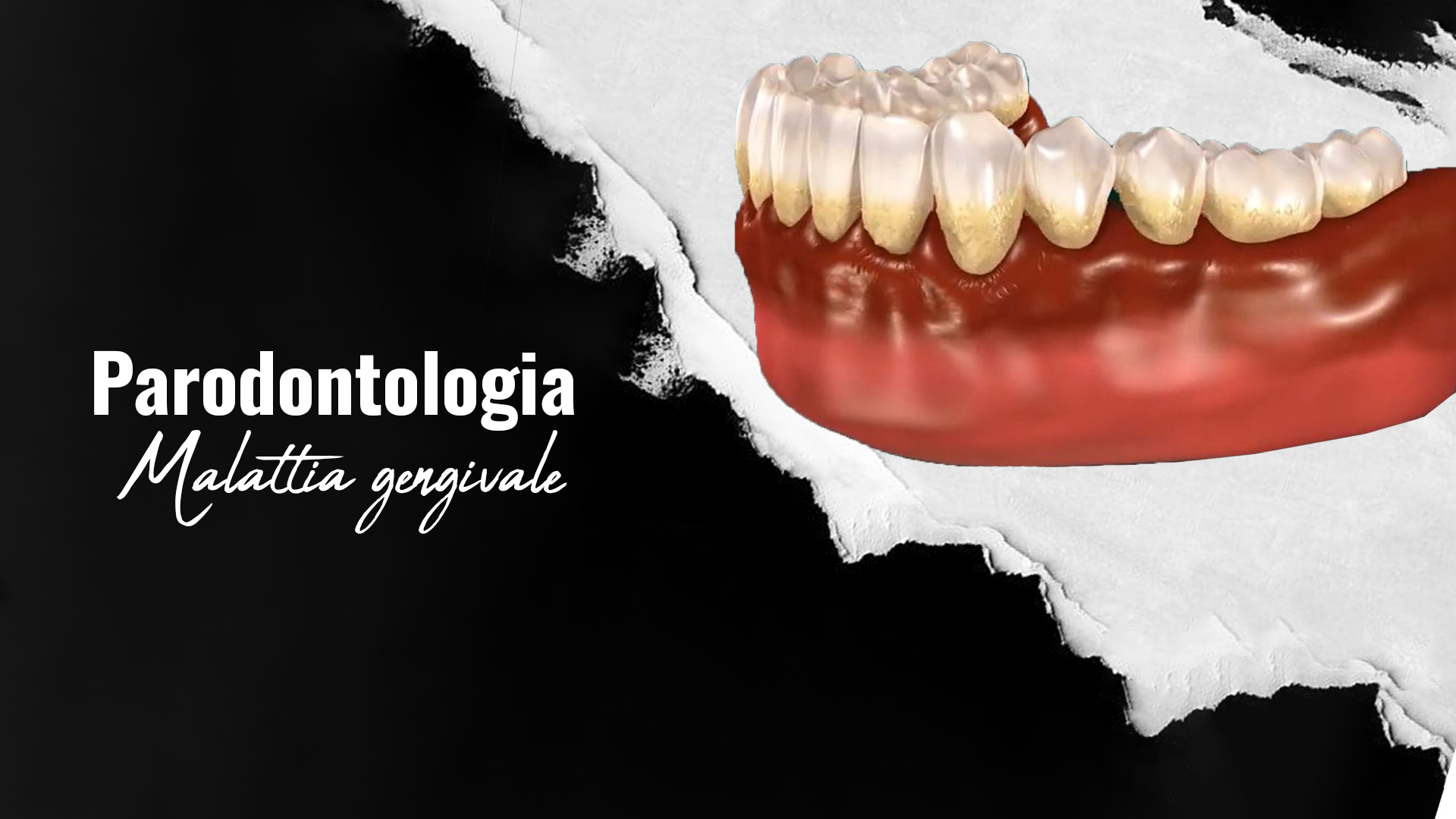 Parodontologia-a-Istanbul-Turchia