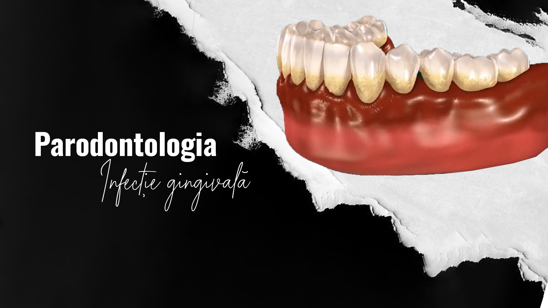 Parodontologia-in-IstanbulTurcia