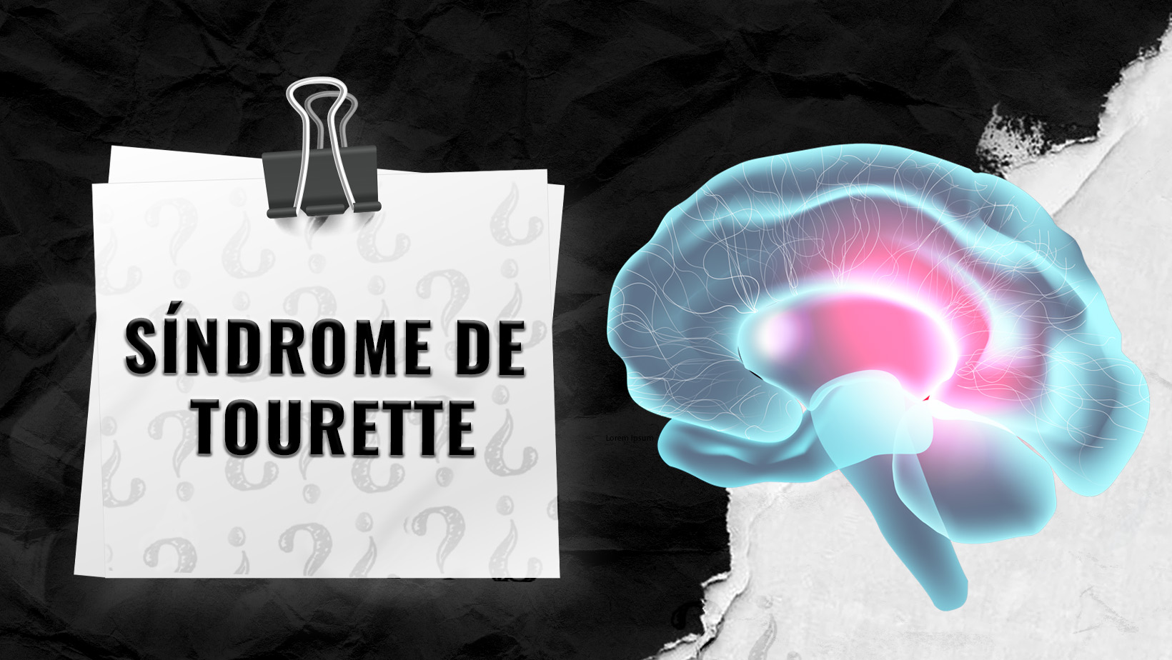 Sindrome-de-Tourette