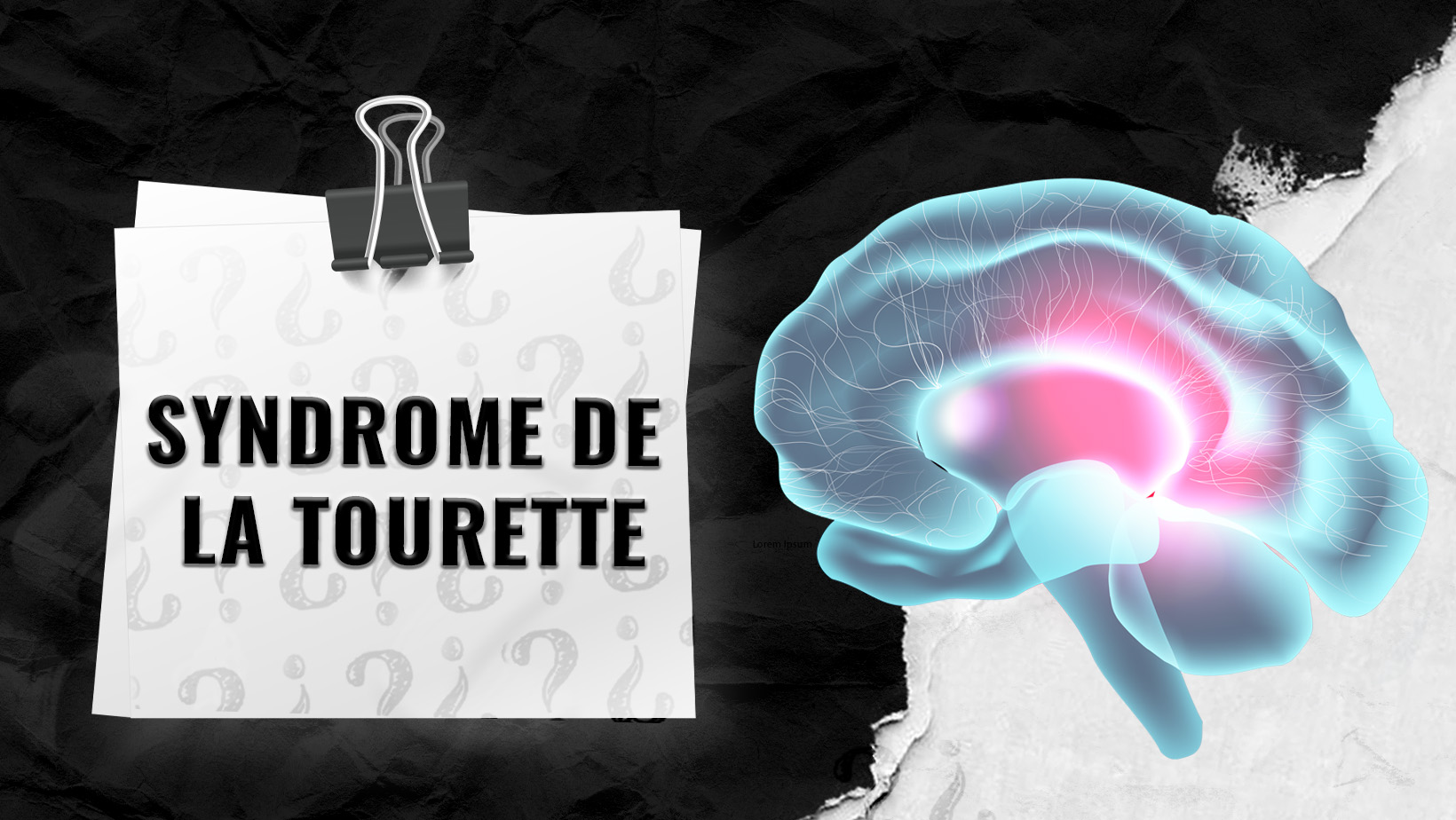 Syndrome-de-la-Tourette