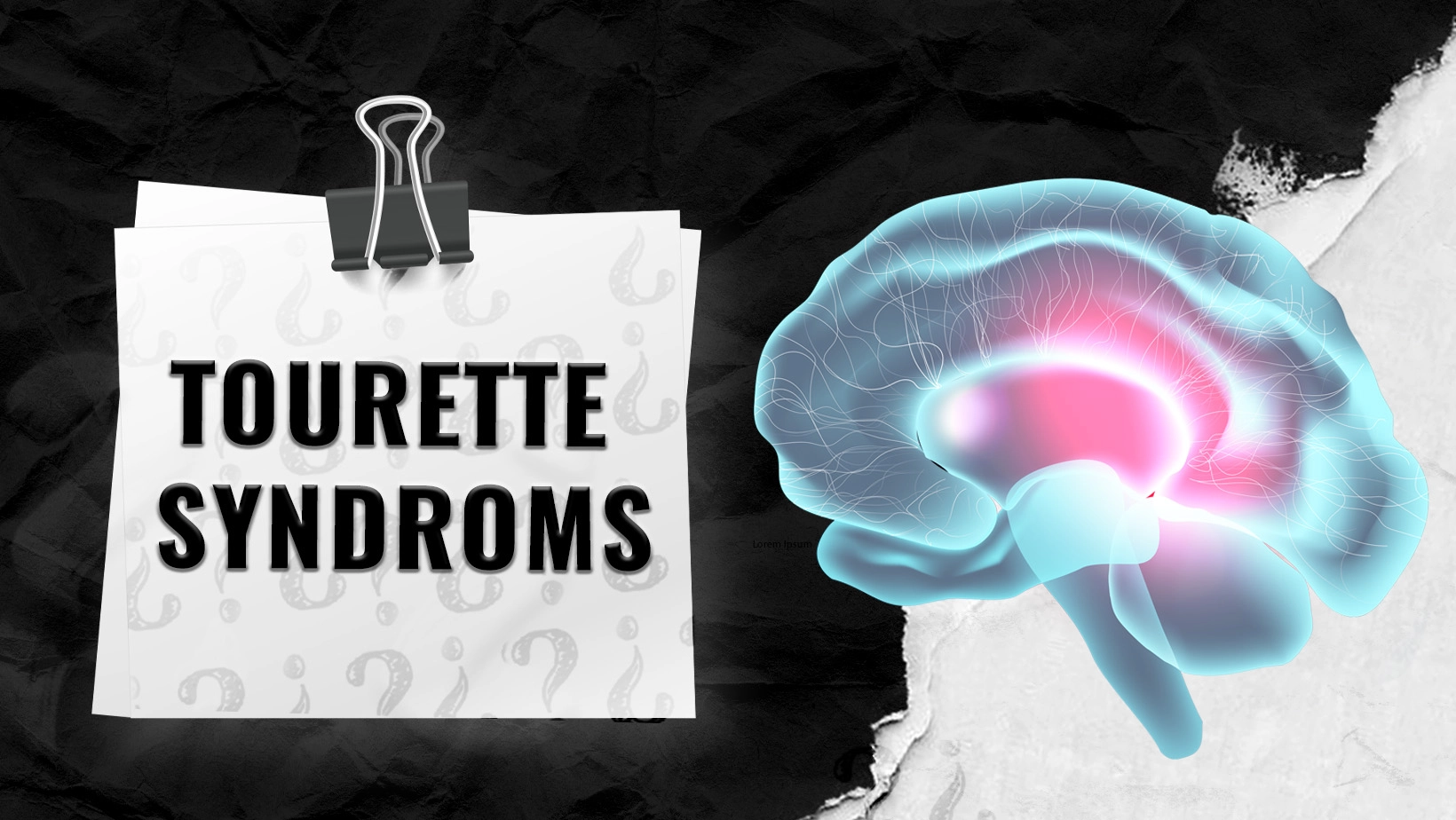 Tourette-Syndrom