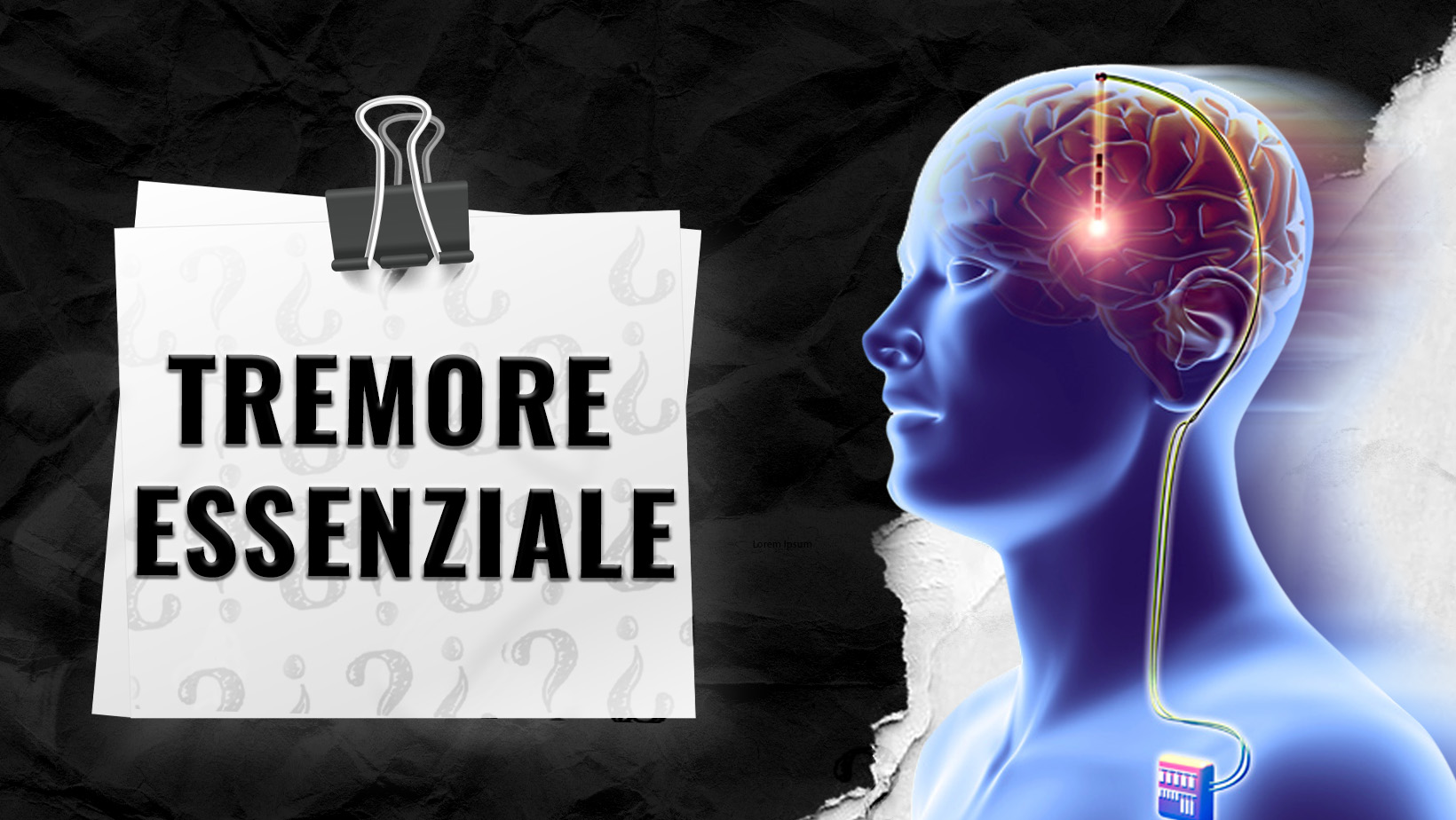 Tremore-Essenziale