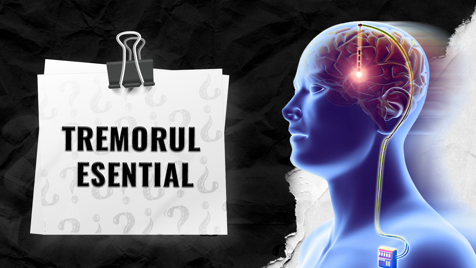 Tremorul-Esential