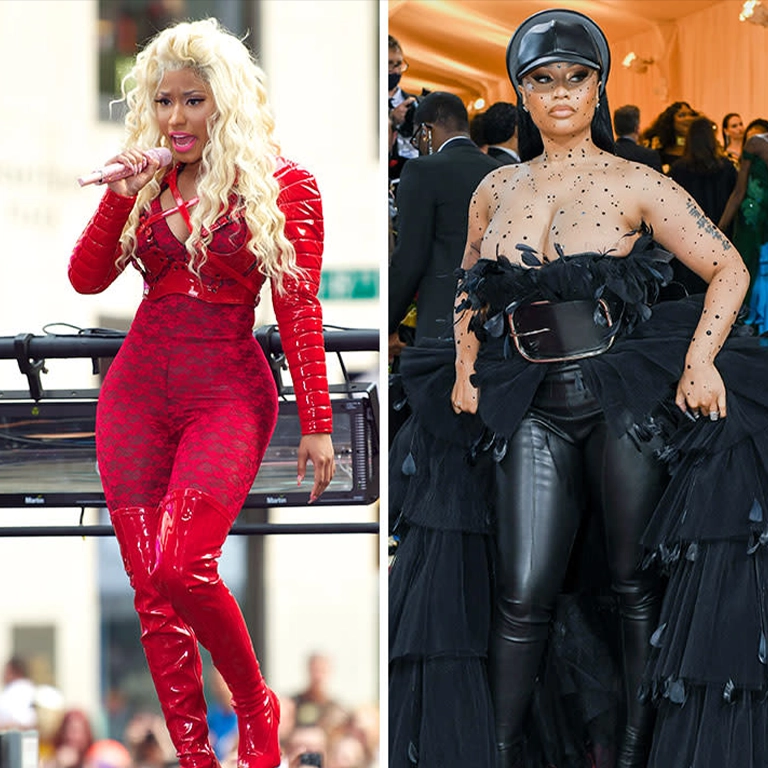 Why Do Celebrities Like Nicki Minaj Opt for Plastic Surgery