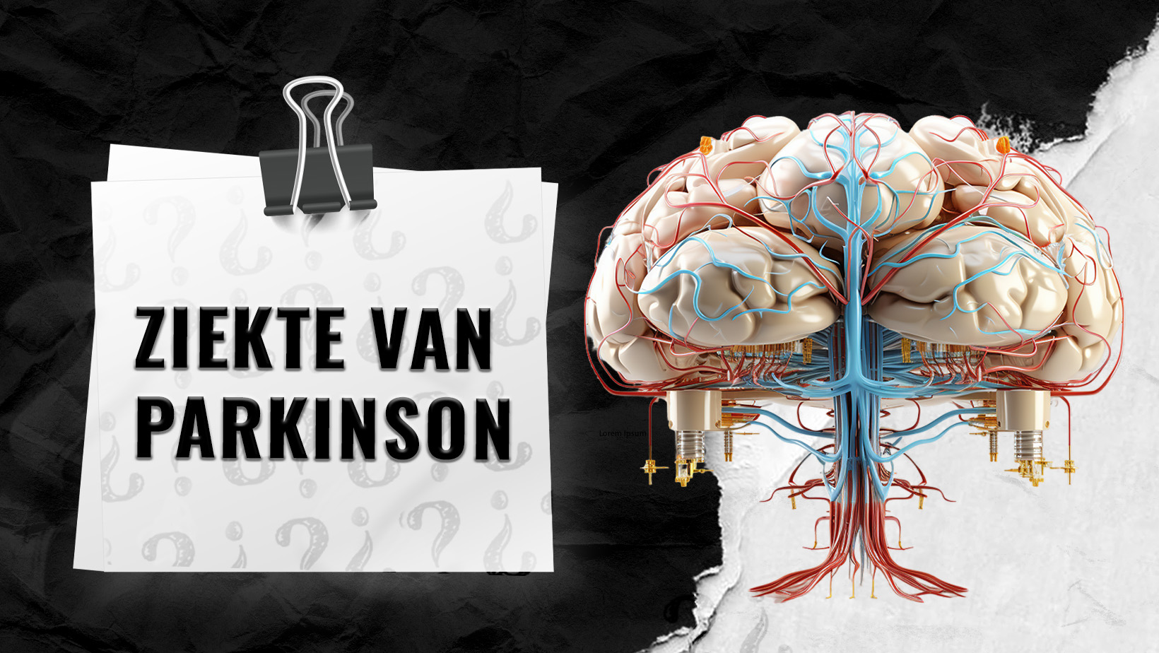 Ziekte-van-Parkinson