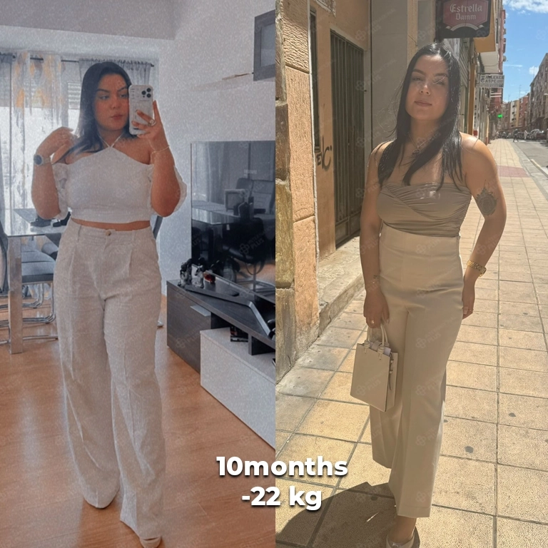 bariatric surgery before after 22